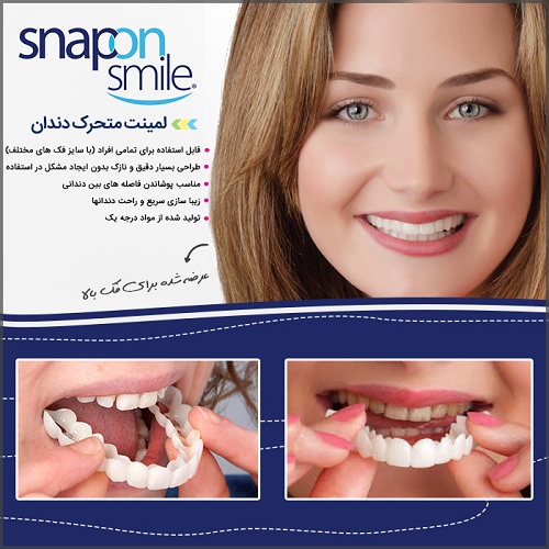 خرید لمینت متحرک دندان - Snap On Smile